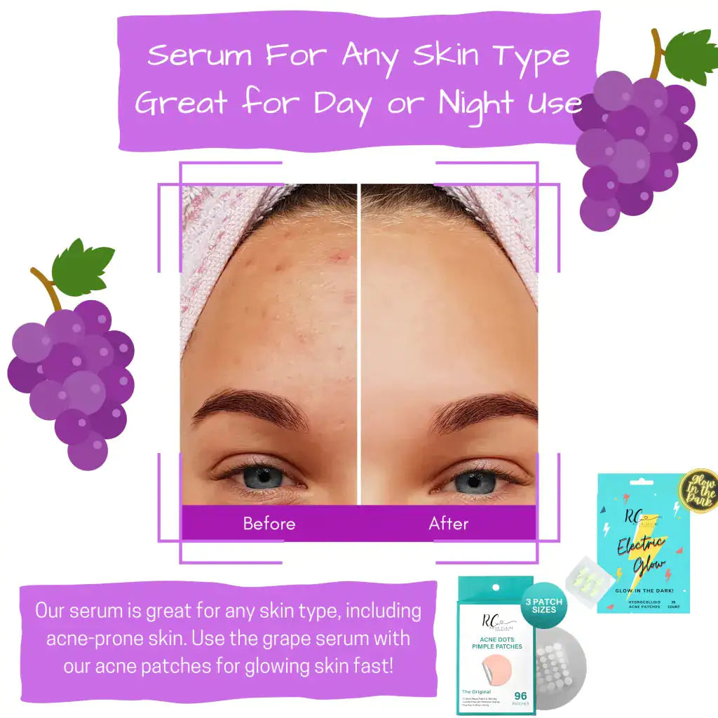 Grape + Hyaluronic Acid Serum – Hydrating Antioxidant Boost